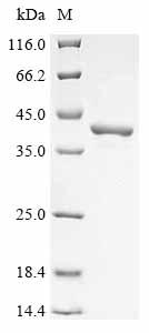 (Tris-Glycine gel) Discontinuous SDS-PAGE (reduced) with 5% enrichment gel and 15% separation gel. (Tris-Glycine gel) Discontinuous SDS-PAGE (reduced) with 5% enrichment gel and 15% separation gel.