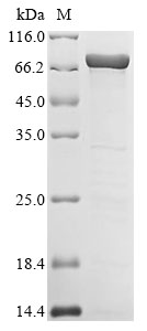 (Tris-Glycine gel) Discontinuous SDS-PAGE (reduced) with 5% enrichment gel and 15% separation gel. (Tris-Glycine gel) Discontinuous SDS-PAGE (reduced) with 5% enrichment gel and 15% separation gel.