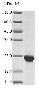 (Tris-Glycine gel) Discontinuous SDS-PAGE (reduced) with 5% enrichment gel and 15% separation gel. (Tris-Glycine gel) Discontinuous SDS-PAGE (reduced) with 5% enrichment gel and 15% separation gel.