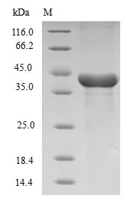 (Tris-Glycine gel) Discontinuous SDS-PAGE (reduced) with 5% enrichment gel and 15% separation gel. (Tris-Glycine gel) Discontinuous SDS-PAGE (reduced) with 5% enrichment gel and 15% separation gel.