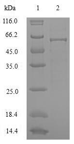 (Tris-Glycine gel) Discontinuous SDS-PAGE (reduced) with 5% enrichment gel and 15% separation gel. (Tris-Glycine gel) Discontinuous SDS-PAGE (reduced) with 5% enrichment gel and 15% separation gel.