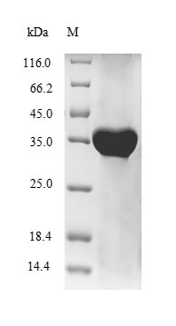 (Tris-Glycine gel) Discontinuous SDS-PAGE (reduced) with 5% enrichment gel and 15% separation gel. (Tris-Glycine gel) Discontinuous SDS-PAGE (reduced) with 5% enrichment gel and 15% separation gel.