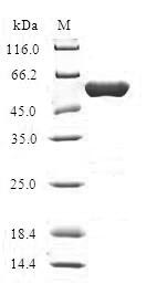 (Tris-Glycine gel) Discontinuous SDS-PAGE (reduced) with 5% enrichment gel and 15% separation gel. (Tris-Glycine gel) Discontinuous SDS-PAGE (reduced) with 5% enrichment gel and 15% separation gel.
