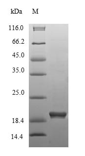 (Tris-Glycine gel) Discontinuous SDS-PAGE (reduced) with 5% enrichment gel and 15% separation gel. (Tris-Glycine gel) Discontinuous SDS-PAGE (reduced) with 5% enrichment gel and 15% separation gel.