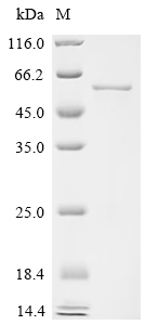 Recombinant Mouse Hydroxymethylglutaryl-CoA synthase, mitochondrial (Hmgcs2) - image 1