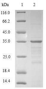 (Tris-Glycine gel) Discontinuous SDS-PAGE (reduced) with 5% enrichment gel and 15% separation gel. (Tris-Glycine gel) Discontinuous SDS-PAGE (reduced) with 5% enrichment gel and 15% separation gel.