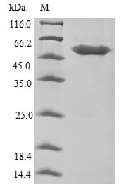 SDS-PAGE- Recombinant protein Human HP