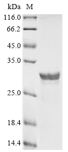 Recombinant Human Neuron-specific calcium-binding protein hippocalcin (HPCA) - image 1