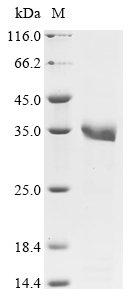 (Tris-Glycine gel) Discontinuous SDS-PAGE (reduced) with 5% enrichment gel and 15% separation gel.