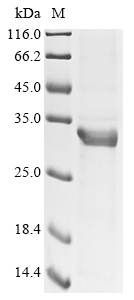 (Tris-Glycine gel) Discontinuous SDS-PAGE (reduced) with 5% enrichment gel and 15% separation gel.