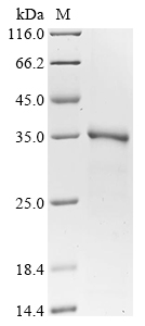 (Tris-Glycine gel) Discontinuous SDS-PAGE (reduced) with 5% enrichment gel and 15% separation gel.