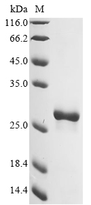 (Tris-Glycine gel) Discontinuous SDS-PAGE (reduced) with 5% enrichment gel and 15% separation gel. (Tris-Glycine gel) Discontinuous SDS-PAGE (reduced) with 5% enrichment gel and 15% separation gel.