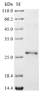 (Tris-Glycine gel) Discontinuous SDS-PAGE (reduced) with 5% enrichment gel and 15% separation gel.