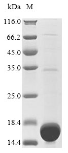 (Tris-Glycine gel) Discontinuous SDS-PAGE (reduced) with 5% enrichment gel and 15% separation gel. (Tris-Glycine gel) Discontinuous SDS-PAGE (reduced) with 5% enrichment gel and 15% separation gel.