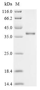 Recombinant Rat Histamine H1 receptor (Hrh1) , partial - image 1