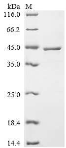 Recombinant Human Estradiol 17-beta-dehydrogenase 1 (HSD17B1) - image 1