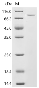 Recombinant Human Peroxisomal multifunctional enzyme type 2 (HSD17B4) - image 1