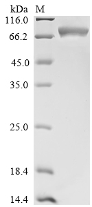 (Tris-Glycine gel) Discontinuous SDS-PAGE (reduced) with 5% enrichment gel and 15% separation gel. (Tris-Glycine gel) Discontinuous SDS-PAGE (reduced) with 5% enrichment gel and 15% separation gel.
