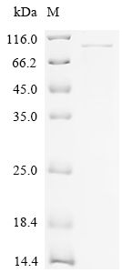 Recombinant Human Alpha-L-iduronidase (IDUA) - image 1