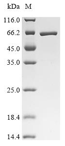 Recombinant Human Interferon-induced protein with tetratricopeptide repeats 1 (IFIT1) - image 1
