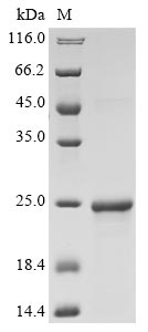 (Tris-Glycine gel) Discontinuous SDS-PAGE (reduced) with 5% enrichment gel and 15% separation gel. (Tris-Glycine gel) Discontinuous SDS-PAGE (reduced) with 5% enrichment gel and 15% separation gel.