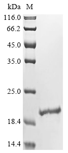 (Tris-Glycine gel) Discontinuous SDS-PAGE (reduced) with 5% enrichment gel and 15% separation gel. (Tris-Glycine gel) Discontinuous SDS-PAGE (reduced) with 5% enrichment gel and 15% separation gel.