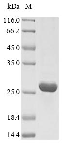 SDS-PAGE- Recombinant protein Human IGF1R