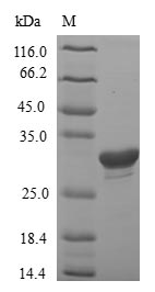 (Tris-Glycine gel) Discontinuous SDS-PAGE (reduced) with 5% enrichment gel and 15% separation gel. (Tris-Glycine gel) Discontinuous SDS-PAGE (reduced) with 5% enrichment gel and 15% separation gel.
