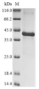 Recombinant Human Insulin-like growth factor-binding protein 5 (IGFBP5) - image 1