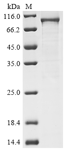 (Tris-Glycine gel) Discontinuous SDS-PAGE (reduced) with 5% enrichment gel and 15% separation gel. (Tris-Glycine gel) Discontinuous SDS-PAGE (reduced) with 5% enrichment gel and 15% separation gel.