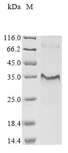 (Tris-Glycine gel) Discontinuous SDS-PAGE (reduced) with 5% enrichment gel and 15% separation gel. (Tris-Glycine gel) Discontinuous SDS-PAGE (reduced) with 5% enrichment gel and 15% separation gel.