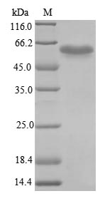 (Tris-Glycine gel) Discontinuous SDS-PAGE (reduced) with 5% enrichment gel and 15% separation gel. (Tris-Glycine gel) Discontinuous SDS-PAGE (reduced) with 5% enrichment gel and 15% separation gel.