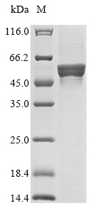 (Tris-Glycine gel) Discontinuous SDS-PAGE (reduced) with 5% enrichment gel and 15% separation gel. (Tris-Glycine gel) Discontinuous SDS-PAGE (reduced) with 5% enrichment gel and 15% separation gel.