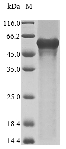 (Tris-Glycine gel) Discontinuous SDS-PAGE (reduced) with 5% enrichment gel and 15% separation gel. (Tris-Glycine gel) Discontinuous SDS-PAGE (reduced) with 5% enrichment gel and 15% separation gel.