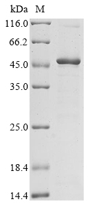 (Tris-Glycine gel) Discontinuous SDS-PAGE (reduced) with 5% enrichment gel and 15% separation gel. (Tris-Glycine gel) Discontinuous SDS-PAGE (reduced) with 5% enrichment gel and 15% separation gel.
