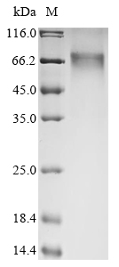 (Tris-Glycine gel) Discontinuous SDS-PAGE (reduced) with 5% enrichment gel and 15% separation gel. (Tris-Glycine gel) Discontinuous SDS-PAGE (reduced) with 5% enrichment gel and 15% separation gel.