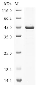 (Tris-Glycine gel) Discontinuous SDS-PAGE (reduced) with 5% enrichment gel and 15% separation gel. (Tris-Glycine gel) Discontinuous SDS-PAGE (reduced) with 5% enrichment gel and 15% separation gel.