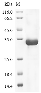 (Tris-Glycine gel) Discontinuous SDS-PAGE (reduced) with 5% enrichment gel and 15% separation gel. (Tris-Glycine gel) Discontinuous SDS-PAGE (reduced) with 5% enrichment gel and 15% separation gel.