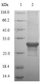 (Tris-Glycine gel) Discontinuous SDS-PAGE (reduced) with 5% enrichment gel and 15% separation gel. (Tris-Glycine gel) Discontinuous SDS-PAGE (reduced) with 5% enrichment gel and 15% separation gel.
