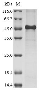 Recombinant Human Kielin/chordin-like protein (KCP) , partial - image 1