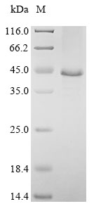 (Tris-Glycine gel) Discontinuous SDS-PAGE (reduced) with 5% enrichment gel and 15% separation gel. (Tris-Glycine gel) Discontinuous SDS-PAGE (reduced) with 5% enrichment gel and 15% separation gel.