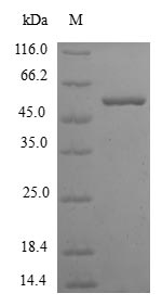 (Tris-Glycine gel) Discontinuous SDS-PAGE (reduced) with 5% enrichment gel and 15% separation gel. (Tris-Glycine gel) Discontinuous SDS-PAGE (reduced) with 5% enrichment gel and 15% separation gel.