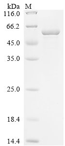 Recombinant Human Kinesin-1 heavy chain (KIF5B) , partial - image 1
