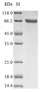 (Tris-Glycine gel) Discontinuous SDS-PAGE (reduced) with 5% enrichment gel and 15% separation gel. (Tris-Glycine gel) Discontinuous SDS-PAGE (reduced) with 5% enrichment gel and 15% separation gel.
