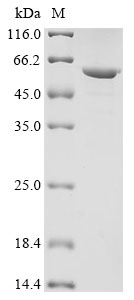 Recombinant Human Keratin, type I cytoskeletal 13 (KRT13) - image 1