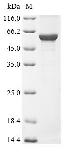 Recombinant Human Keratin, type I cytoskeletal 16 (KRT16) - image 1