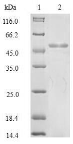 (Tris-Glycine gel) Discontinuous SDS-PAGE (reduced) with 5% enrichment gel and 15% separation gel. (Tris-Glycine gel) Discontinuous SDS-PAGE (reduced) with 5% enrichment gel and 15% separation gel.