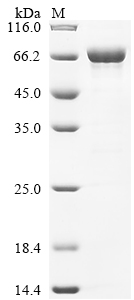 Recombinant Human Keratin, type II cytoskeletal 2 epidermal (KRT2) - image 1