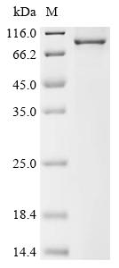 Recombinant Human Keratin, type II cytoskeletal 6A (KRT6A) - image 1