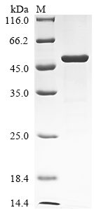 (Tris-Glycine gel) Discontinuous SDS-PAGE (reduced) with 5% enrichment gel and 15% separation gel. (Tris-Glycine gel) Discontinuous SDS-PAGE (reduced) with 5% enrichment gel and 15% separation gel.